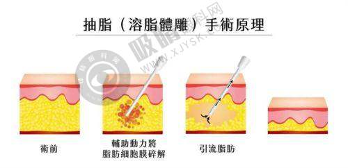 绵阳热门整形项目及价格参考