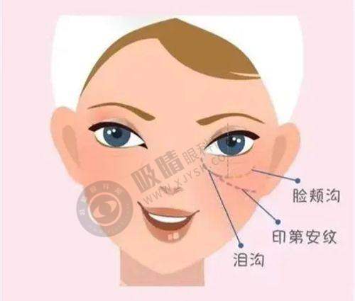 武汉艺星祛眼袋总结感悟