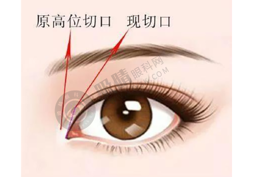 承德医学院附属医院医疗美容科怎么样？专业医生团队+先进技术助您变美