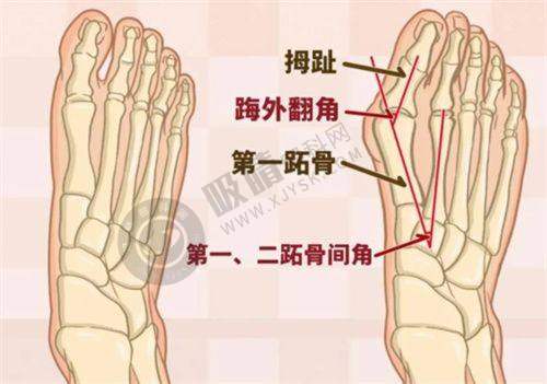 郑州杨小顺医疗美容门诊部怎么样啊？微创拉皮技术口碑好，平行双眼皮恢复快自然美