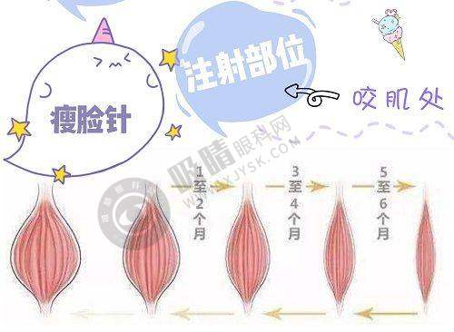 郑州尊雅尚医疗美容诊所怎么样啊?真实实例见证品质