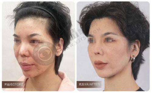 郑州杨小顺医疗美容门诊部怎么样啊?设备优势保护成效