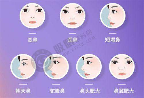 郑州柒加贰医疗美容门诊部怎么样啊?——眼部整形专精有特色