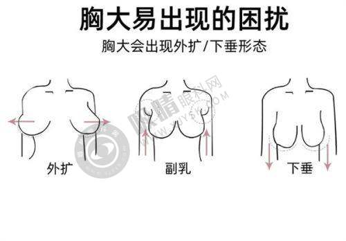 郑州方胜医疗美容诊所怎么样啊?——精良设备助力医美