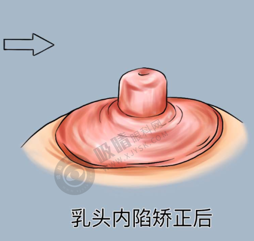 中山韩妃医疗美容门诊部有哪些特色项目?