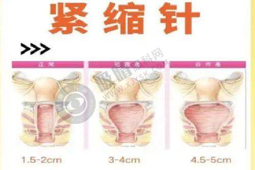 郑州仁慧国内外医疗美容诊所口碑如何?