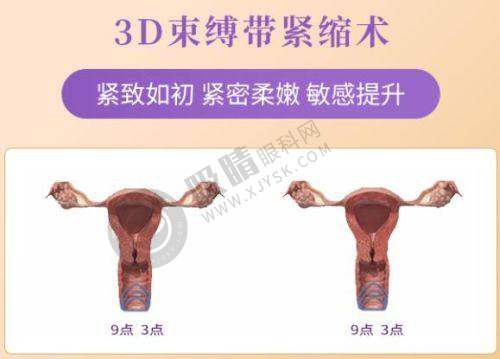 郑州巨星医疗美容诊所其他热门项目介绍