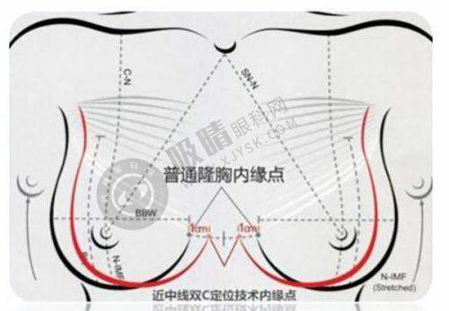 郑州巨星医疗美容诊所面部整形手术怎么样?