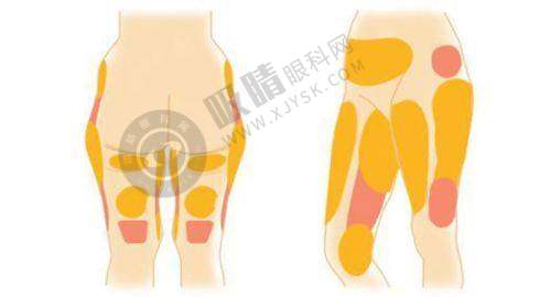 王晓琳医生详细介绍——广州焕新颜医疗美容门诊部的璀璨之星