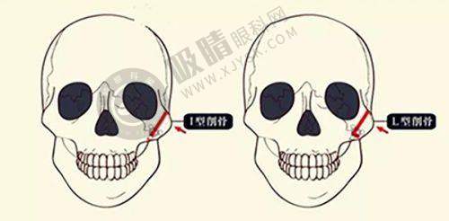 郑州百荟医疗美容门诊部面部整形效果如何？专业团队+先进设备打造自然精致五官
