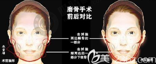 巩义美宸医疗美容诊所的国内外骨干医生团队