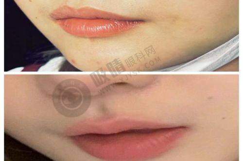 郑州艺德雅医疗美容门诊部怎么样?顾客评价如何?