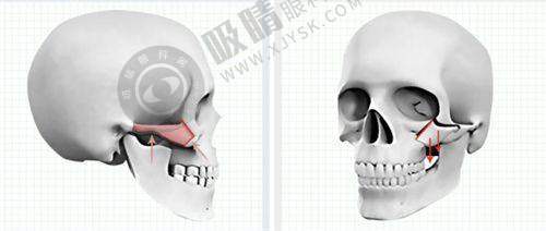 郑州秋涛医疗美容诊所怎么样?——高新科技美肤真实实例分享