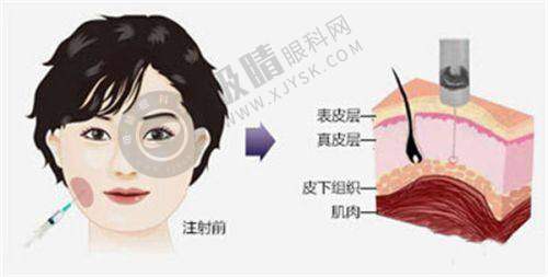 郑州神话医疗美容诊所怎么样?骨干医生团队是关键