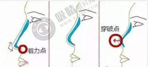 郑州康伦医疗美容诊所怎么样?周边相关医美项目对比