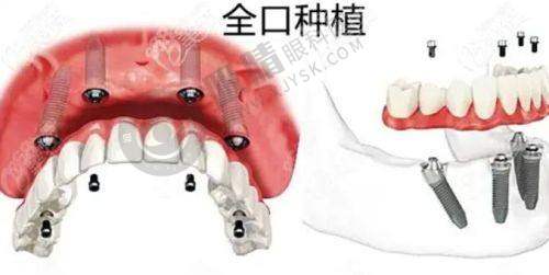 广州广大口腔值得信赖