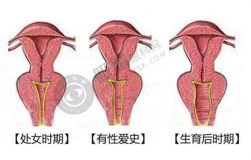 郑州菲林医疗美容门诊部怎么样?——微痛脂肪移植技术亮点