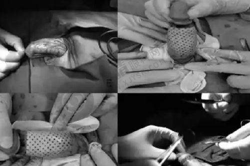 郑州春语整形美容医院怎么样？专注眼鼻整形/去川字纹技术好，医生团队经验丰富口碑佳