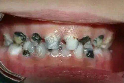 深圳友睦口腔是几级?患者的信赖之选