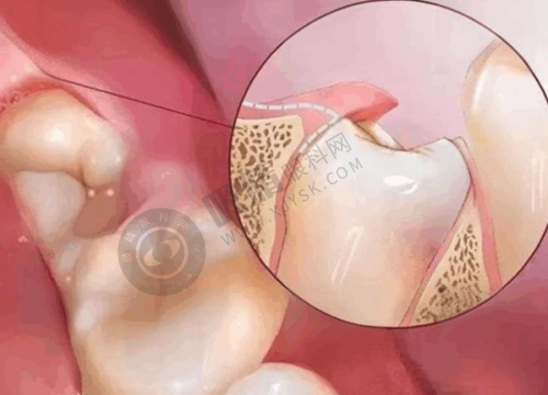 深圳友睦口腔是几级?深圳友睦口腔(兴茂口腔门诊部)——专注正畸的口腔门诊部