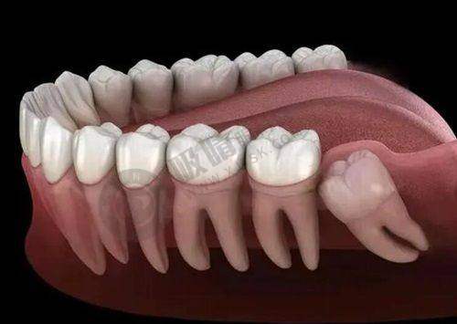 去深圳友睦口腔坐几号线?华强北店2/7/8号线直达,陈钢医生种植牙23500元起