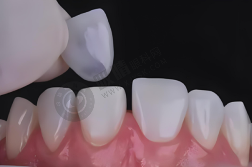 东莞东城国贸口腔门诊部怎么样?——技术优势显著