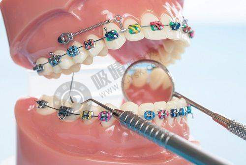 深圳友睦口腔是几级医院?二级专科医院资质,数字化种植正畸技术获好评