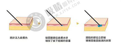 郑州悦美美容医院怎么样?精良设备助力医美项目