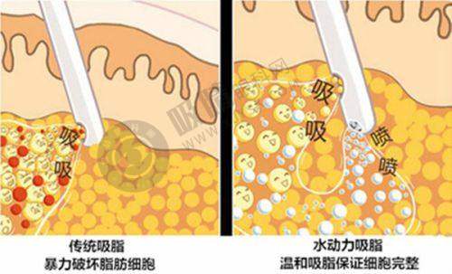 郑州阿姆森医疗美容诊所是正规医院吗?——良好口碑见证其品质