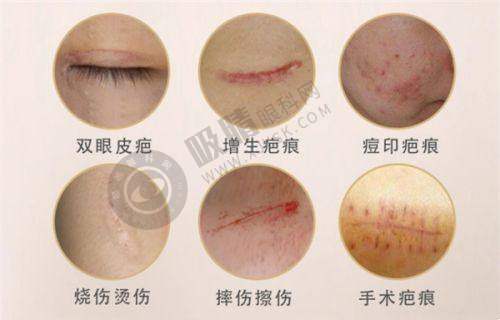 郑州顺柳妲美医疗美容门诊部怎么样?——门诊部擅长项目