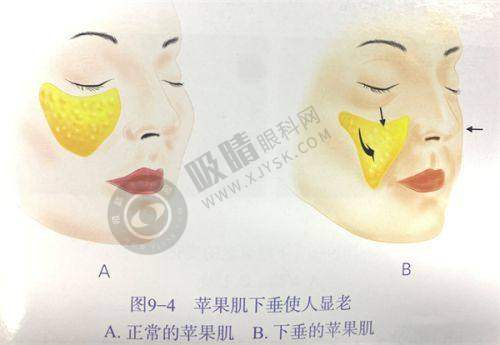 郑州精蝶医疗美容诊所怎么样?——特色医美项目大揭秘