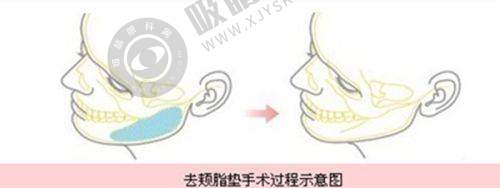 郑州至美国内外整形美容医院是正规医院吗?——国内外标准诊室显实力