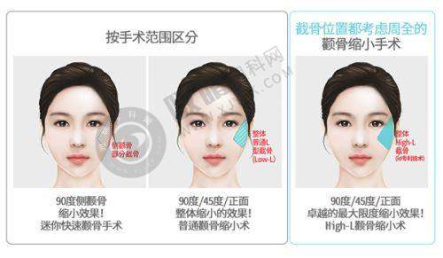 郑州爱美汇医疗美容诊所是正规医院吗?国内外专项技术的魅力