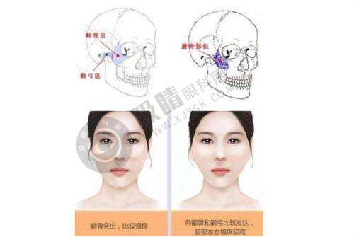 郑州二七博美医疗美容门诊部是正规医院吗?——面部整形项目揭秘