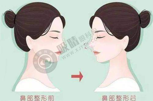 郑州悦美美容医院怎么样?患者评价与口碑如何?
