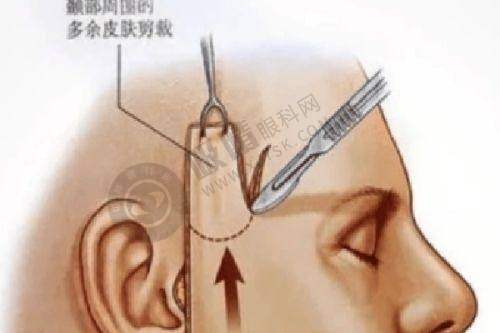 整形项目价格表