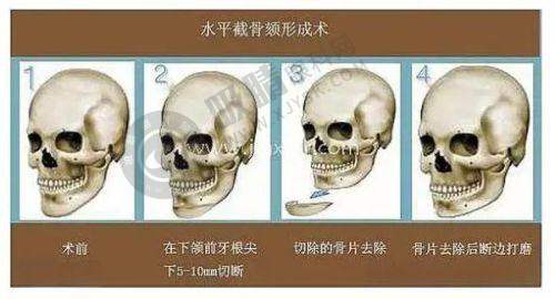 [长沙丽臻医疗美容门诊部]预约挂号方式及流程