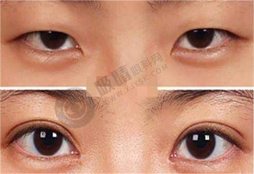 郑州健丽医疗美容诊所正规靠谱吗?——顾客反馈与口碑验证