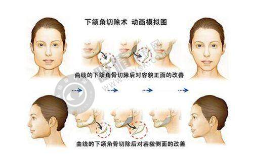 郑州华 山整形医院正规靠谱吗?——特色医美项目全解析