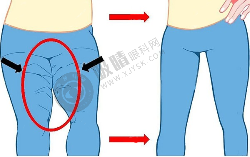 中山艾德琳微整形医院正规靠谱吗?——个性化服务满足不同需求