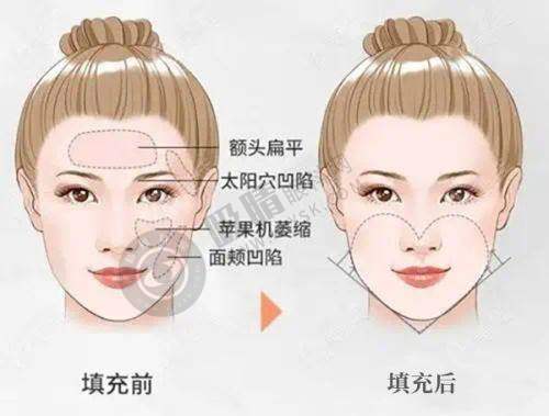 深圳博爱曙光整形医院——良好口碑取奥有保护