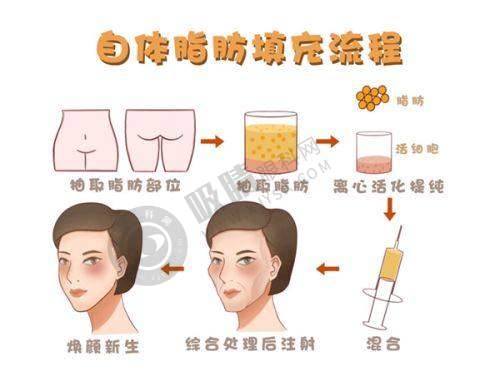 郑州巨星医疗美容诊所正规靠谱吗?——精良设备与专精医生的加持