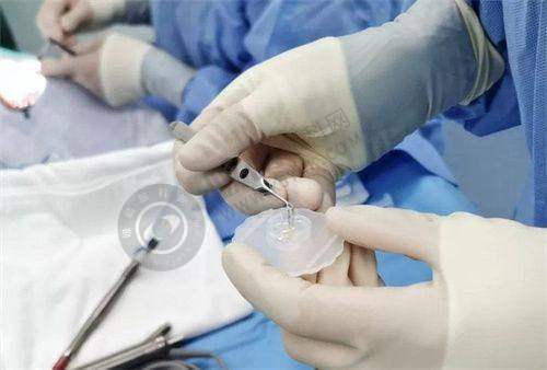 河南省立眼科医院近视手术价格表