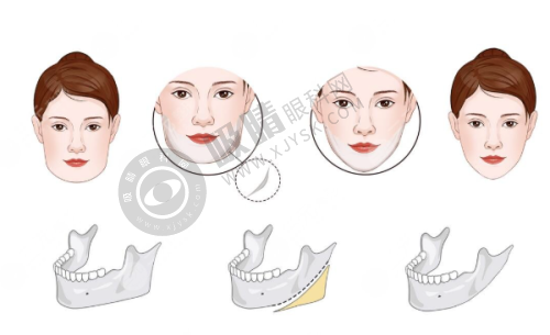 长沙三和整形医院正规靠谱吗?——顾客口碑见证实力