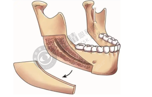 长沙时光医疗美容医院怎么样？精良设备助力美丽蜕变
