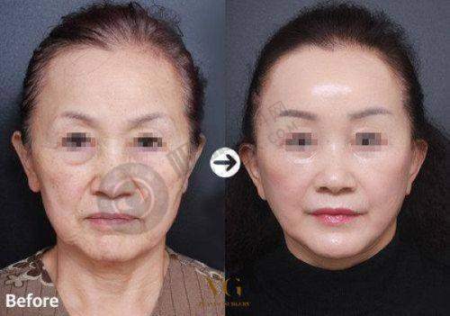 长治郭爱萍医疗美容诊所怎么样?特色医美项目展示