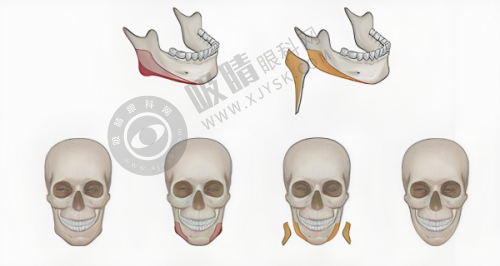 长沙伊百丽梅溪医疗美容门诊部怎么样?韩国技术与设备优势