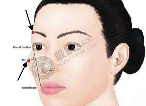 长沙脸博士医疗美容怎么样?23位博士联手创建,眼鼻整形专项技术口碑好