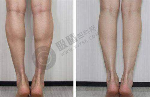 长沙三和整形医院怎么样？真实实例与数据说话