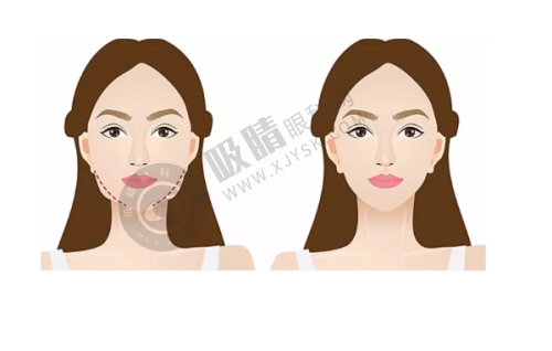 长沙宇美医疗美容门诊部怎么样？专业去眼袋技术获好评，李时雨医生操作精准效果佳